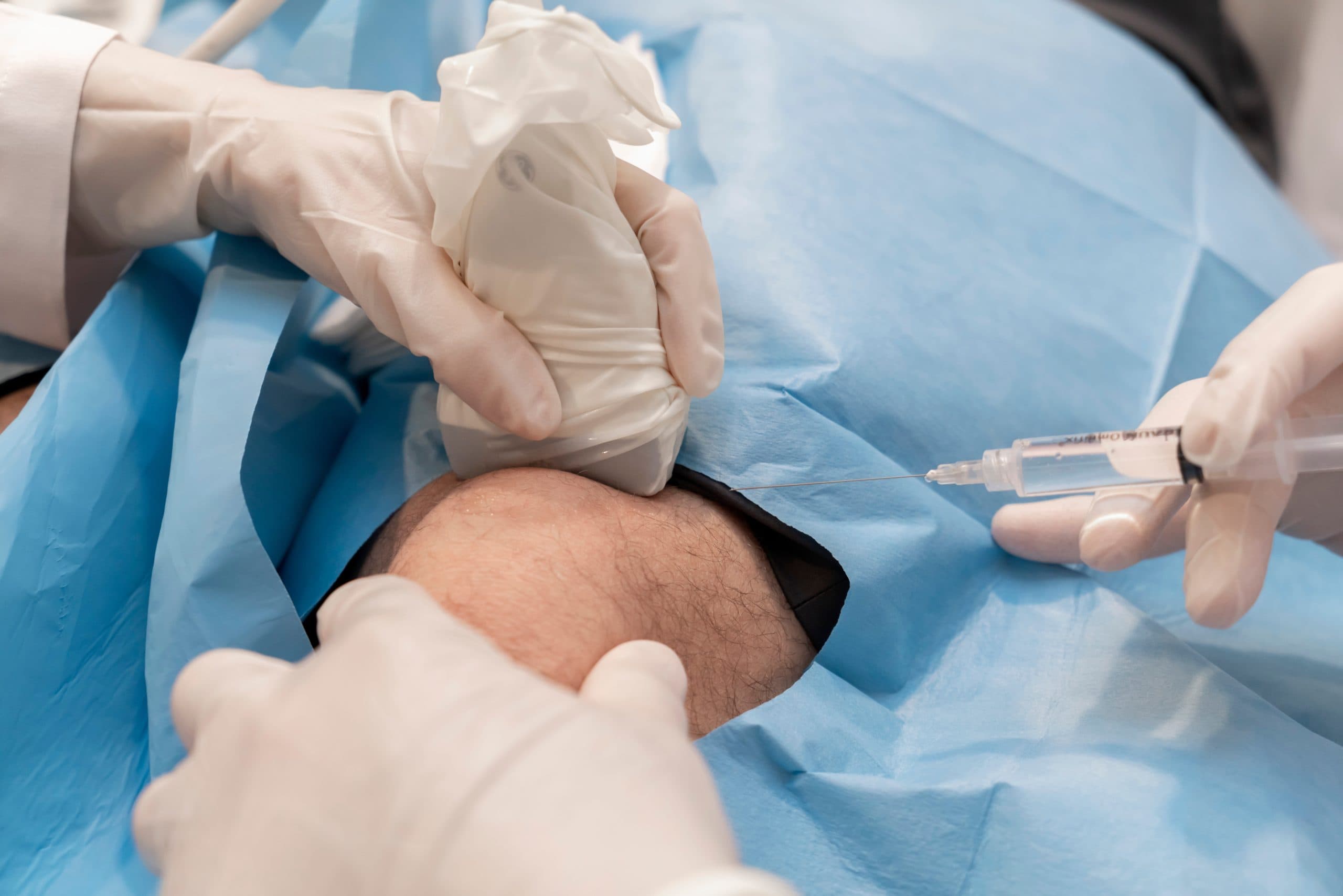 Ultrasound-guided knee injection at London Cartilage Clinic, with the probe on the knee and the needle entering under sterile drapes